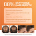 Bosley MD BOSRevive Color Safe Nourishing Shampoo 10.1oz