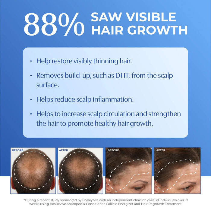 Bosley MD BOSRevive Non Color Treated Hair Starter Pack