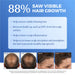 Bosley MD BOSRevive Non Color Treated Hair Volumizing Conditioner 10.1oz