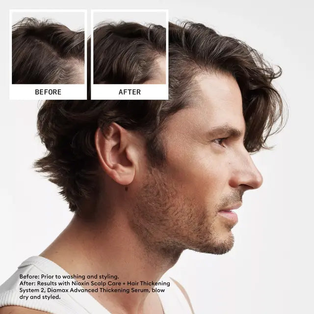 NIOXIN System 2 For Natural Hair With Progressed Thinning, 10.1 oz Each