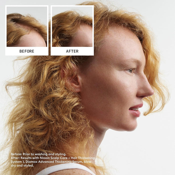 NIOXIN System 1 Scalp Therapy Conditioner For Natural Hair With Light Thinning, 33.8 Oz.