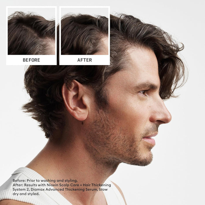 NIOXIN System 2, Scalp Therapy Conditioner For Natural Hair with Progressed Thinning, 16.9 oz