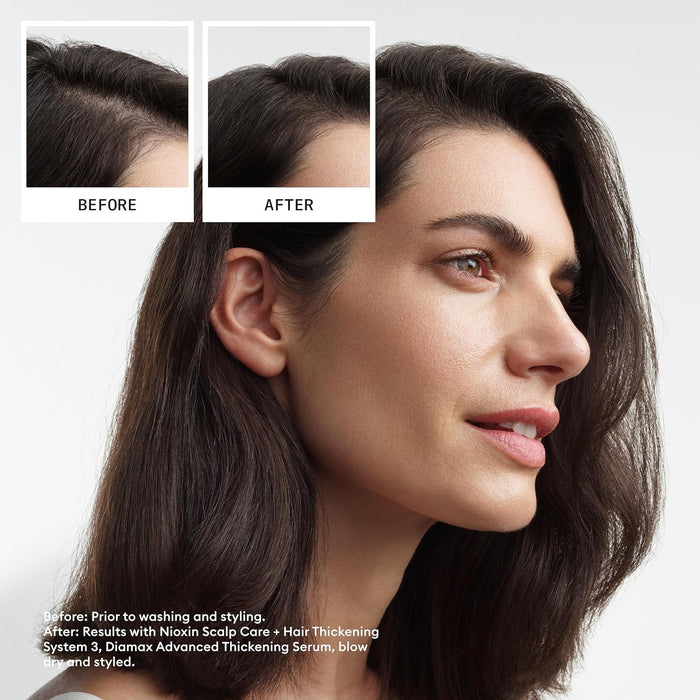 NIOXIN System 3 Scalp, Hair Conditioner For Colored Hair With Light Thinning, 10.1 Oz.